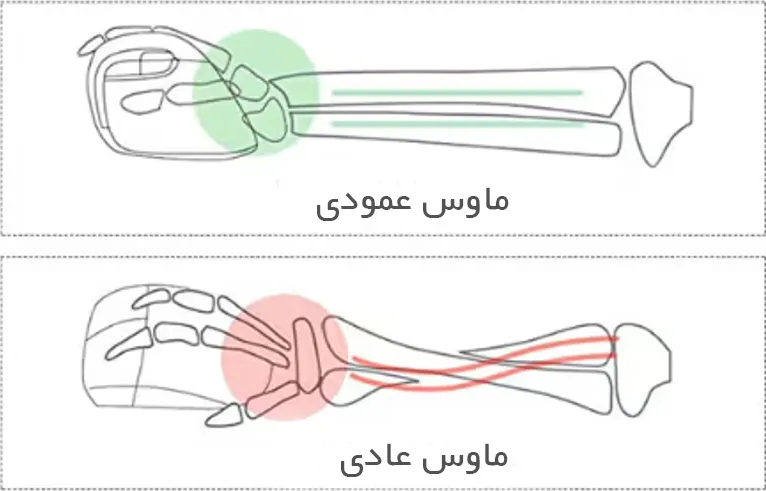تفاوت حالت دست در موسهای عادی و عمودی